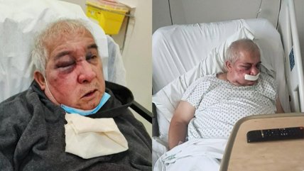   Denuncian brutal golpiza a conserje de 70 años en Vitacura 