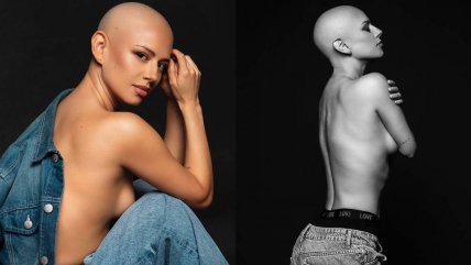  Karla Melo comparte emotiva reflexión tras sexta quimioterapia  